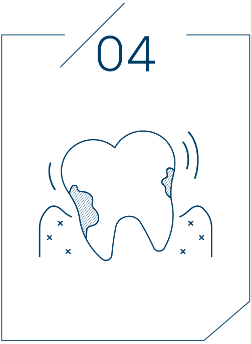 <strong>치아가 흔들림(풍치)</strong>