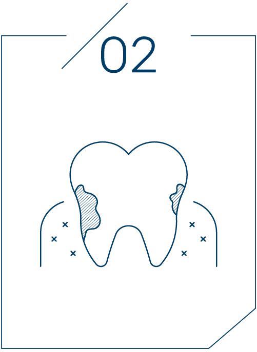 <strong>염증이 생김</strong>