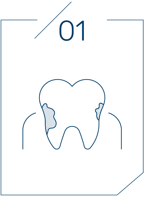 <strong>치태, 치석이 생김</strong>