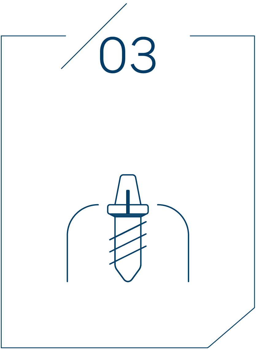 <strong>3단계 지대주 연결</strong>