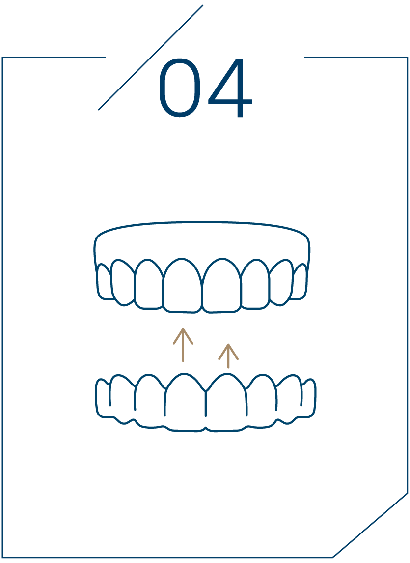 <strong>4단계 사후 유지 관리</strong>