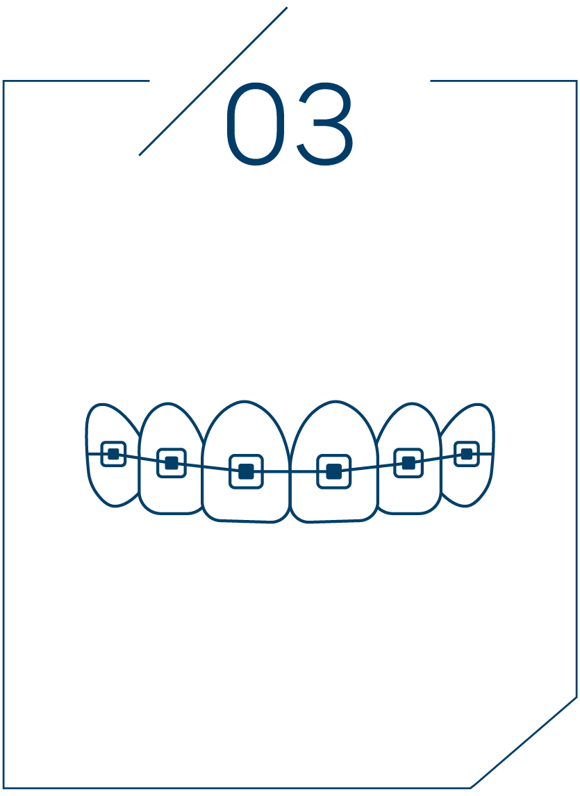 <strong>3단계 교정 치료 진행</strong>