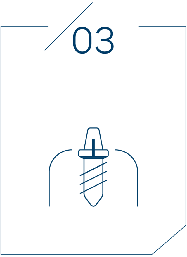 <strong>3단계 지대주 연결</strong>