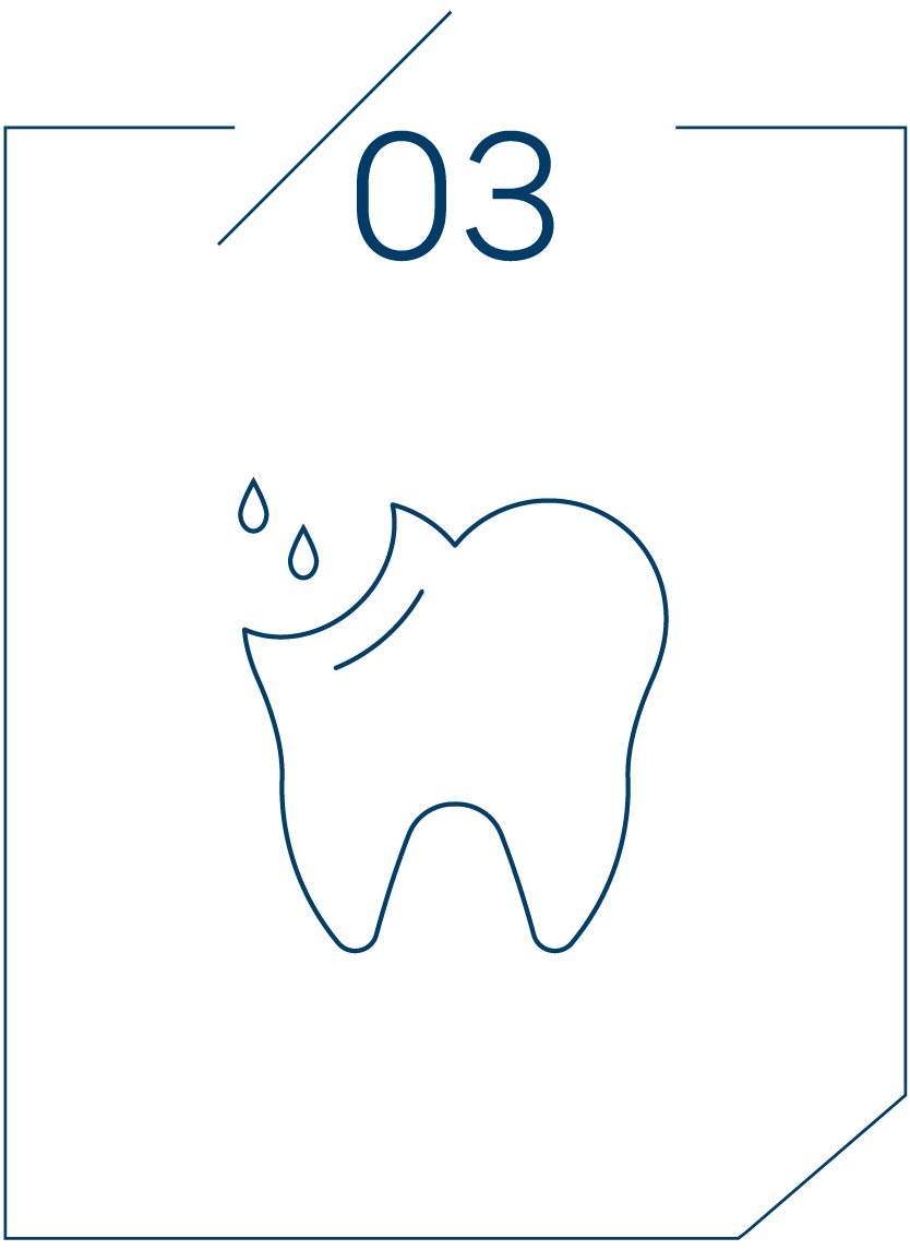 <strong>3단계 레진 충전</strong>