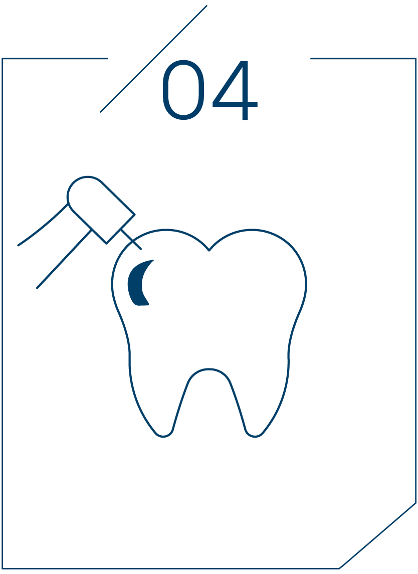<strong>4단계 연마 및 교합 확인</strong>