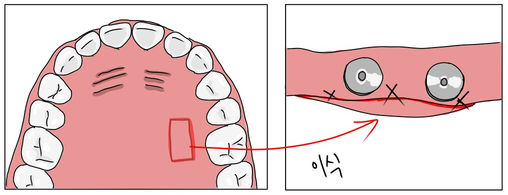 사진 추가 예정