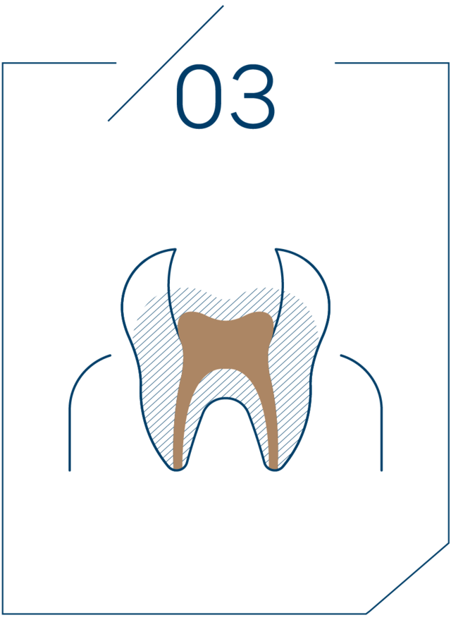 <strong>3단계 신경관 충전</strong>