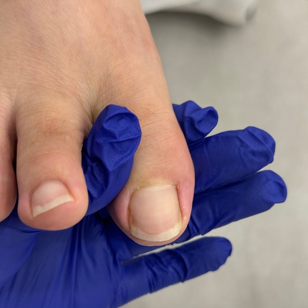 [부산 해운대] 닥터페디 해운대장산점