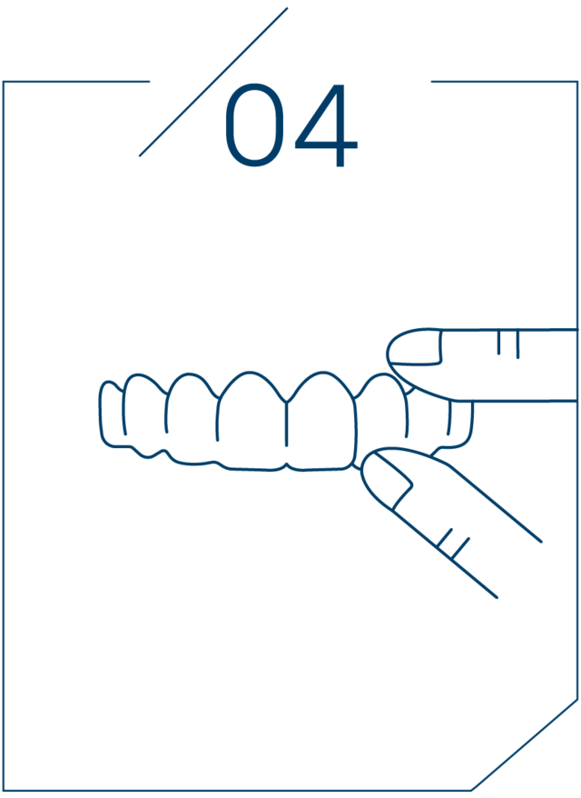 <strong>4단계 틀니 장착 </strong>