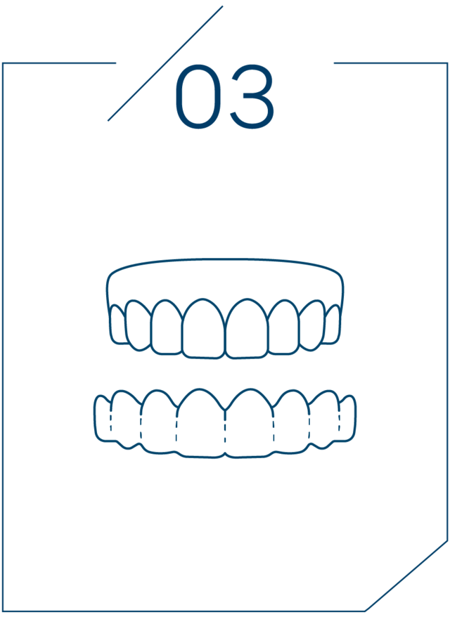 <strong>3단계 인상 채득</strong>