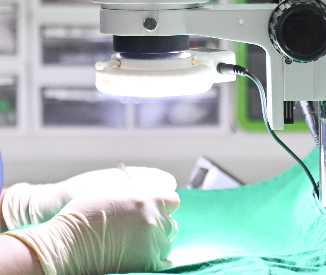 02. 모낭보존 홀딩시스템