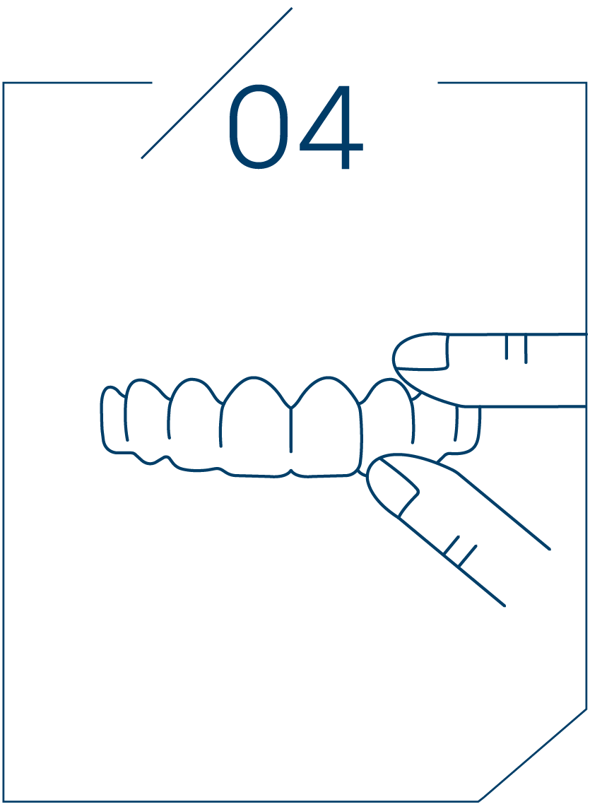 <strong>4단계 틀니 장착</strong>