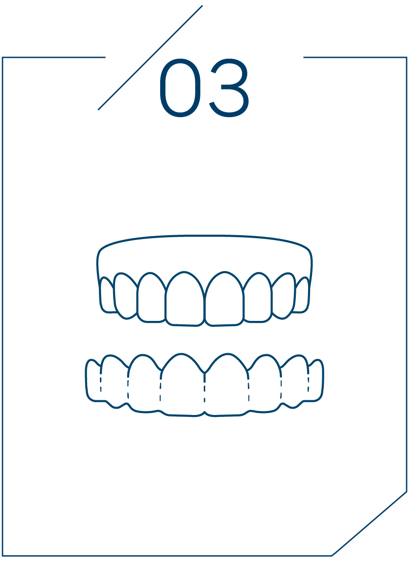 <strong>3단계 인상 채득</strong>