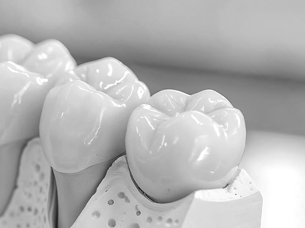 부천-연세미소애치과-보철치료-보철치료적응증