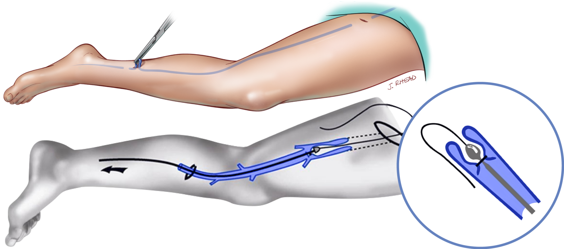 출처 : intermountainhealthcare.org