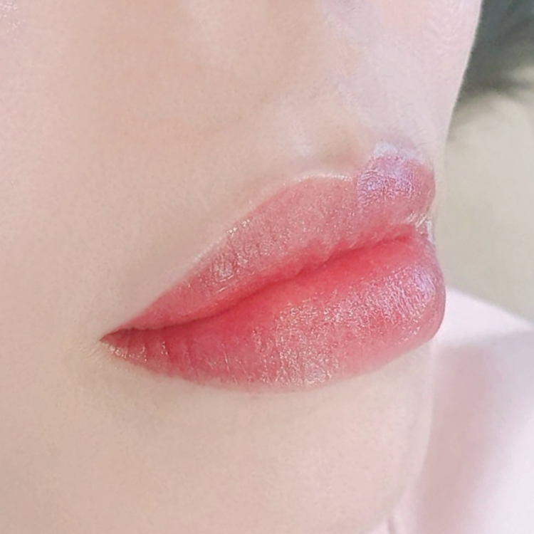 リップ : sizuka clinic