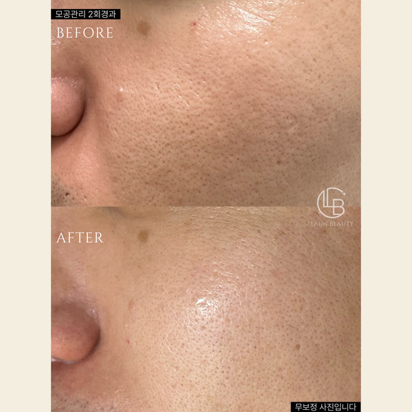 [서울 은평구] 라운뷰티