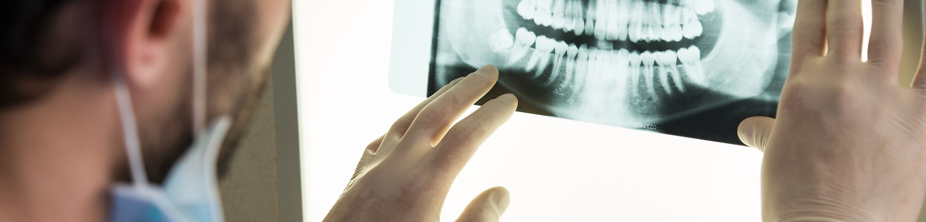 <span style="font-size: 48px; font-weight: bold;">임플란트 재수술</span>