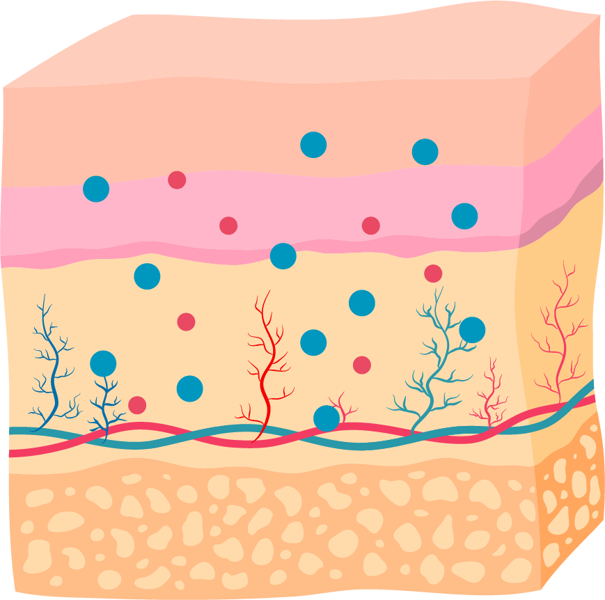 <small><b>LDM</b></small>