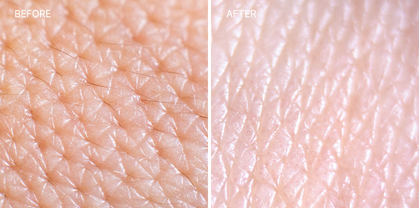 <big><b>감량비책 순</b></big><br><small>30대 여성<br>171.2cm 68.4kg</small>