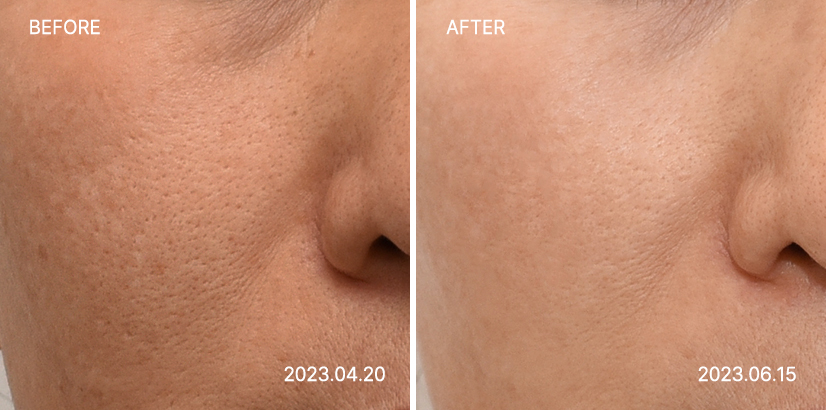 <big><b>감량비책 순</b></big><br><small>30대 여성<br>171.2cm 68.4kg</small>