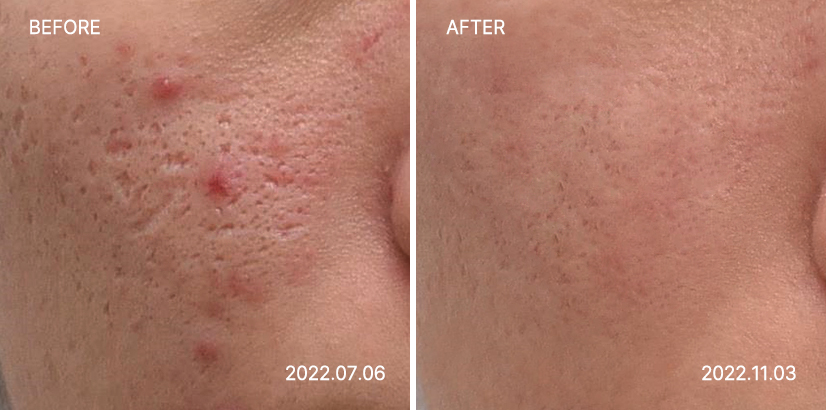 <big><b>감량비책 순</b></big><br><small>30대 여성<br>171.2cm 68.4kg</small>