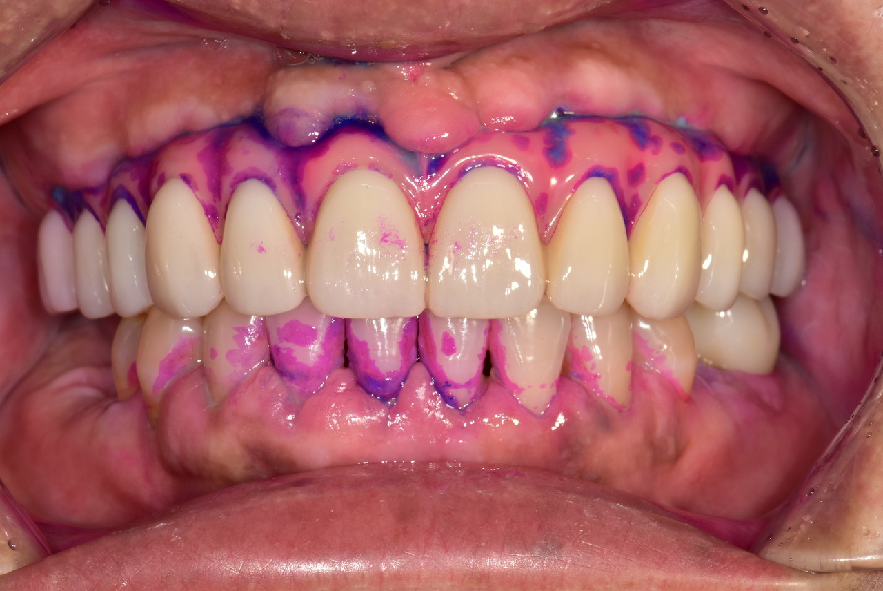 <span style="background:rgba(155, 109, 53, 0.6); padding: 10px 20px; color: #fff; border-radius: 6px;">   마우스를 올려주세요 </span>