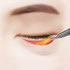 <b>04</b>