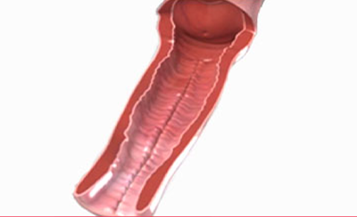 수술후