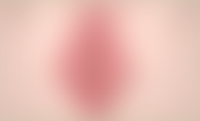 수술전<br>*마우스를 올리면 확인 할 수 있어요