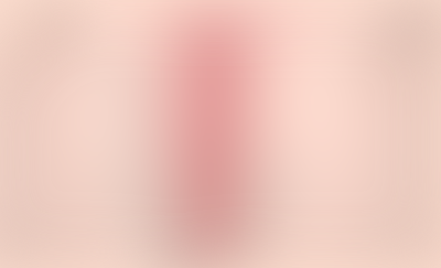 <strong>수술후</strong><br>*클릭하면 확인 할 수 있어요