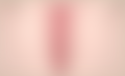 <strong>수술후</strong><br>*클릭하면 확인 할 수 있어요