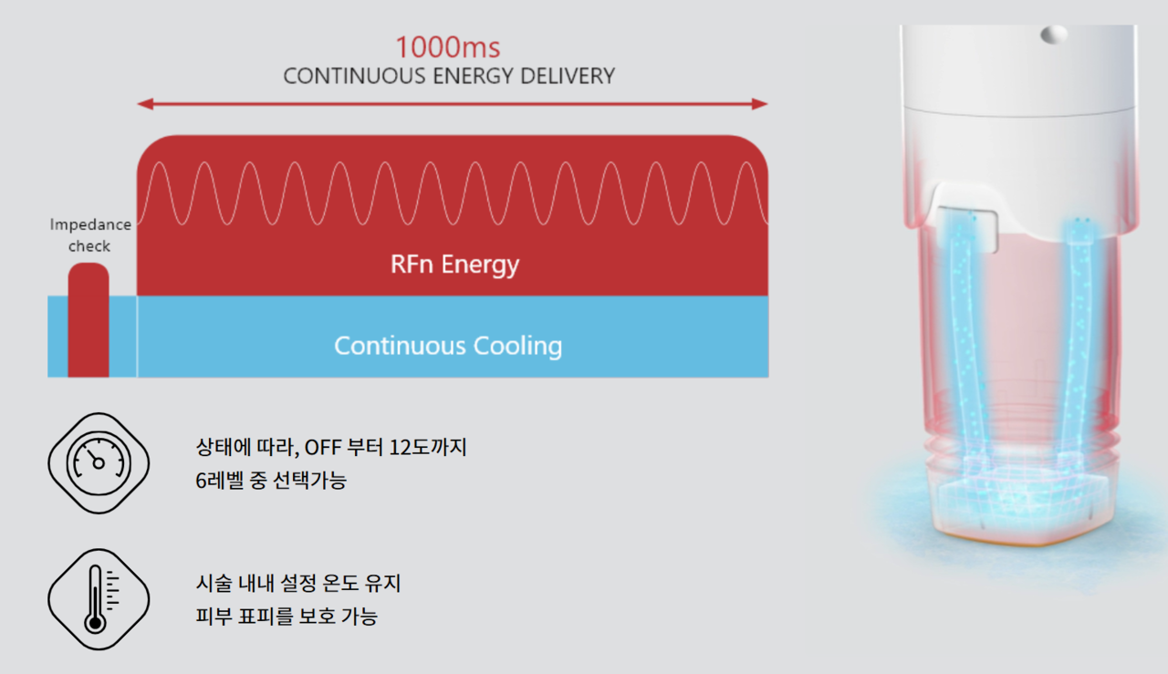 컨티뉴어스 워터쿨링시스템으로 안전하고 통증을 줄인 볼뉴머고주파리프팅  원주피부과 원더스의원