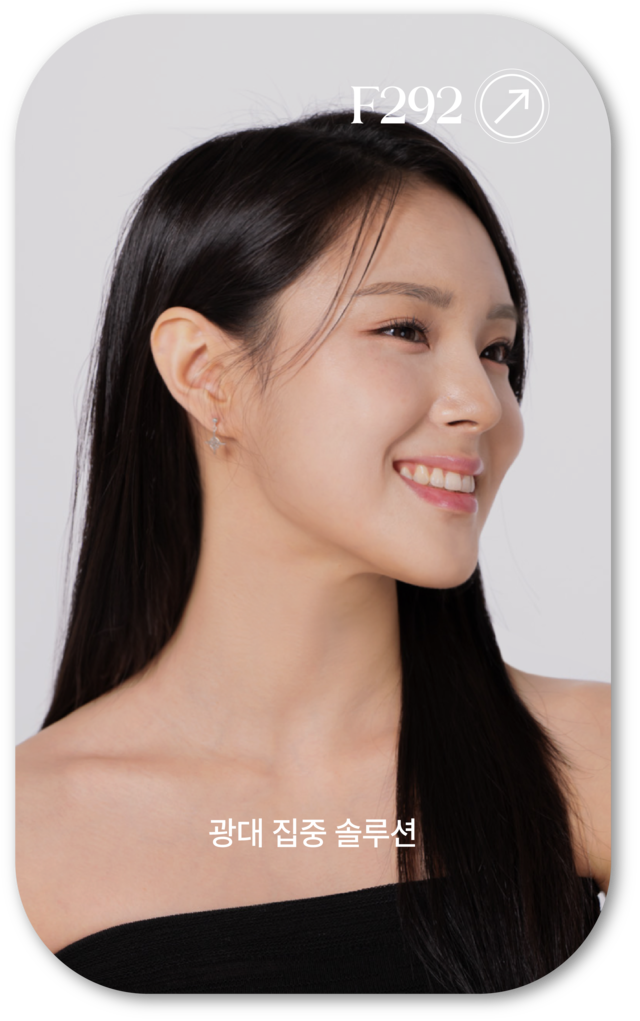 어메이징 빅토리아의 광대 집중 솔루션 모델 사진입니다. 웃고 있는 모델의 광대가 강조되고 있습니다.