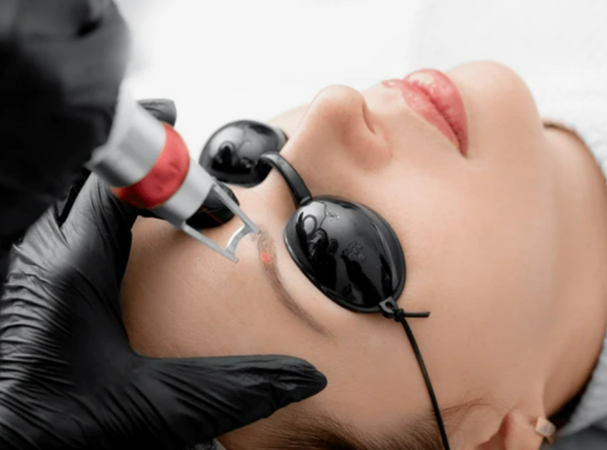 눈썹문신제거 시술을 진행하는 장면 전문의료진