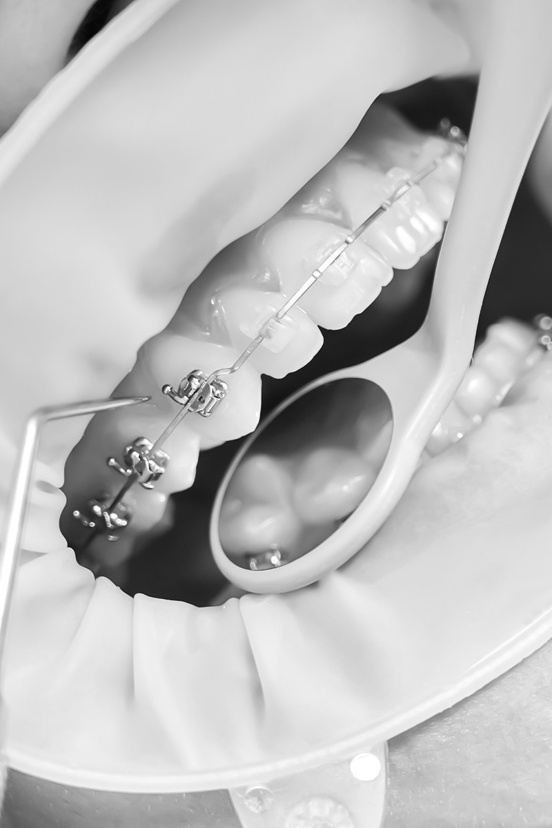 오정구-삼정동-연세미소애치과-스케일링-위생사진료