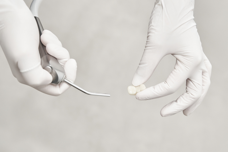 부천-연세미소애치과-크라운치료