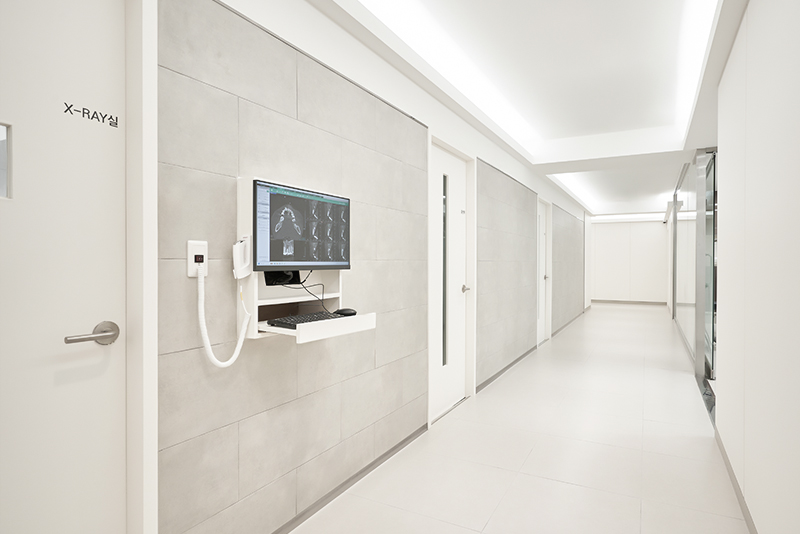 부천-연세미소애치과-인레이치료-치과복도