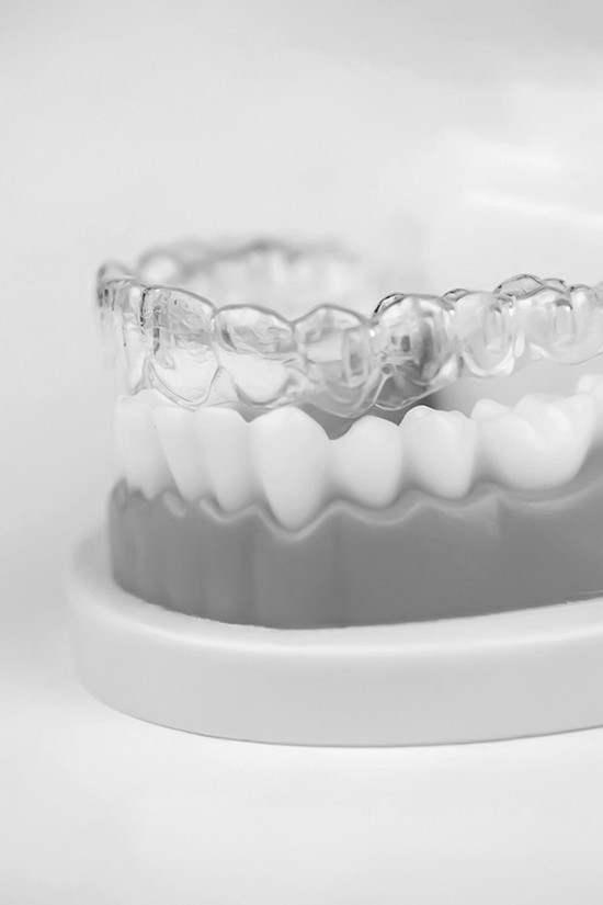 오정구-삼정동-연세미소애치과-교정치료-부분교정진료