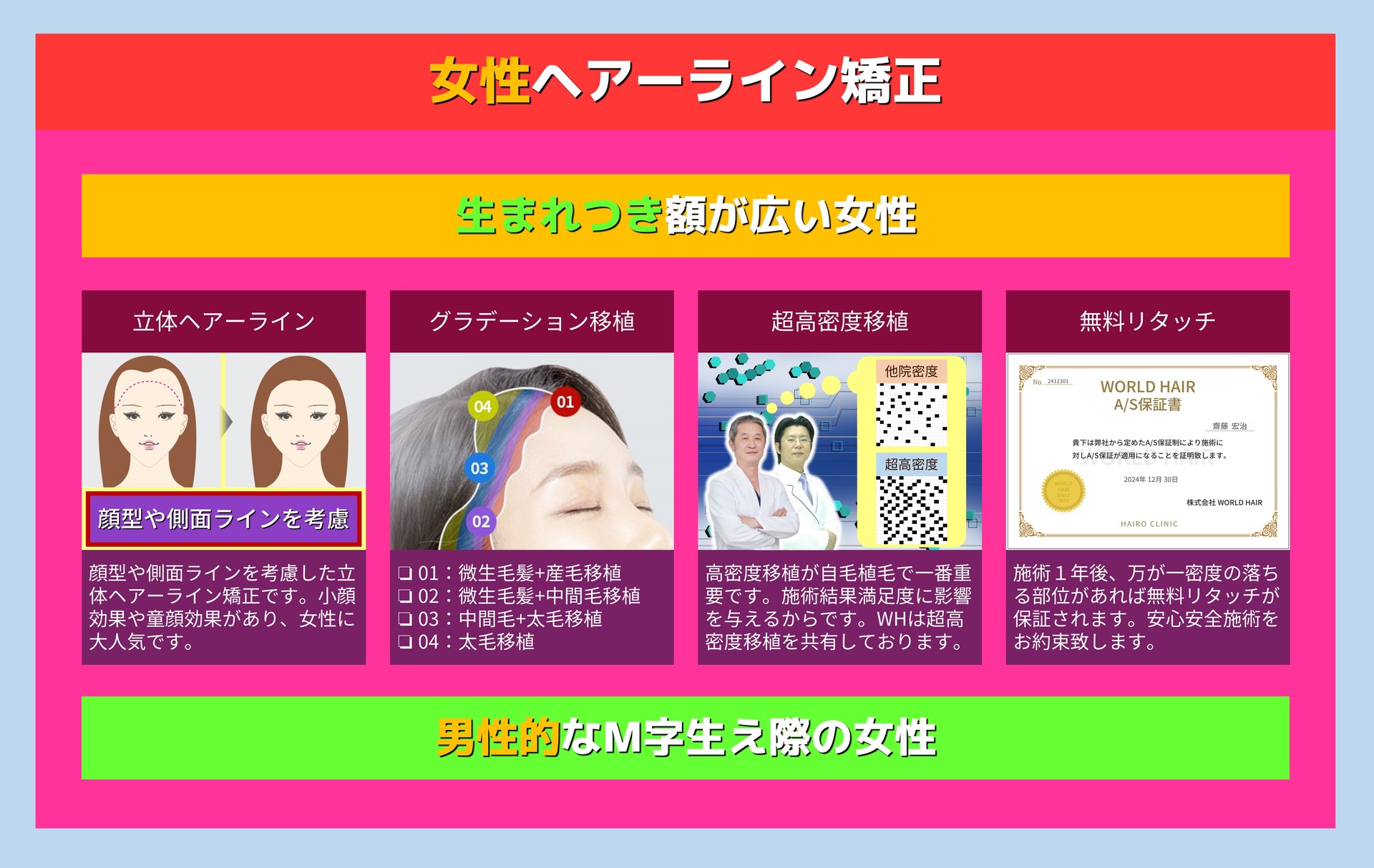 女性ヘアーライン矯正 生まれつき額が広い女性 立体ヘアーライン 顔型や側面ラインを考慮 顔型や側面ラインを考慮した立体ヘアーライン矯正です。小顔効果や童顔効果があり、女性に大人気です。 グラデーション移植 ❏ 01:微生毛髪+産毛移植 ❏ 02:微生毛髪+中間毛移植 ❏ 03:中間毛+太毛移植 ❏ 04:太毛移植 超高密度移植 高密度移植が自毛植毛で一番重要です。施術結果満足度に影響を与えるからです。WHは超高密度移植を共有しております。 無料リタッチ 施術1年後、万が一密度の落ちる部位があれば無料リタッチが保証されます。安心安全施術をお約束致します。 男性的なM字生え際の女性