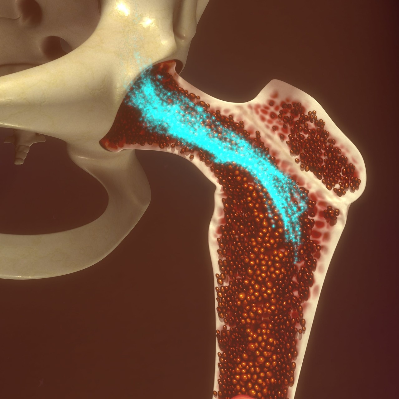 Bone Marrow Stem Cell