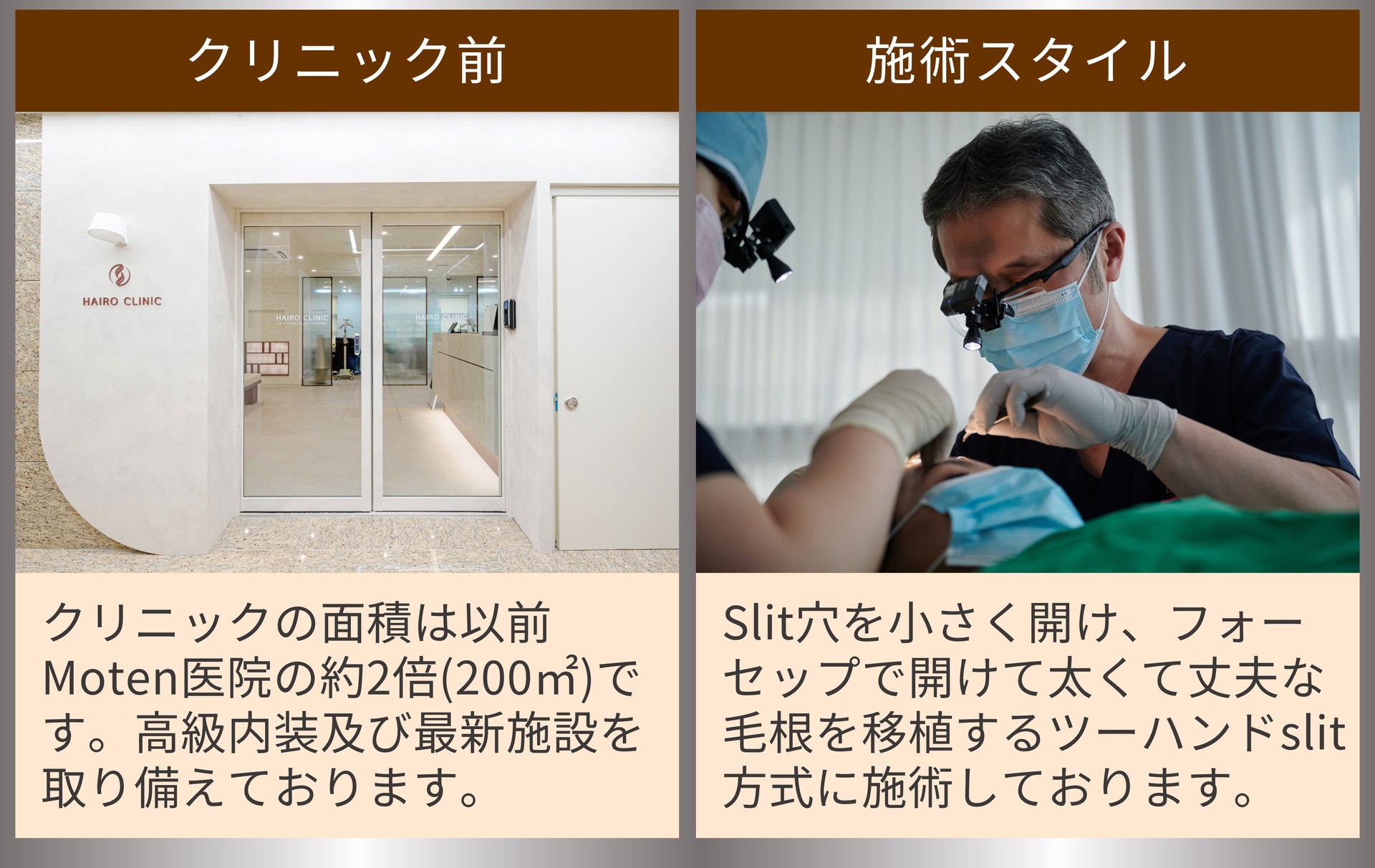 クリニック前 クリニックの面積は以前Moten医院の約2倍(200㎡)です。高級内装及び最新施設を取り備えております。 施術スタイル Slit穴を小さく開け、フォーセップで開けて太くて丈夫な毛根を移植するツーハンドslit方式に施術しております。