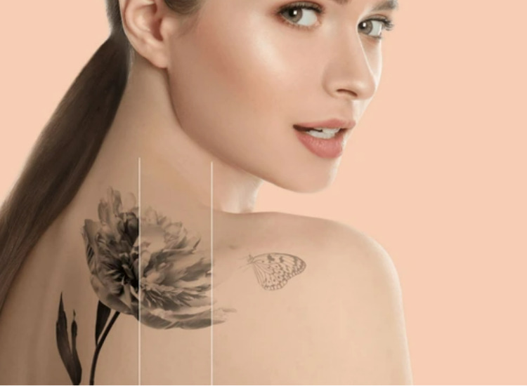 타투제거 깨끗한 피부 클로즈업