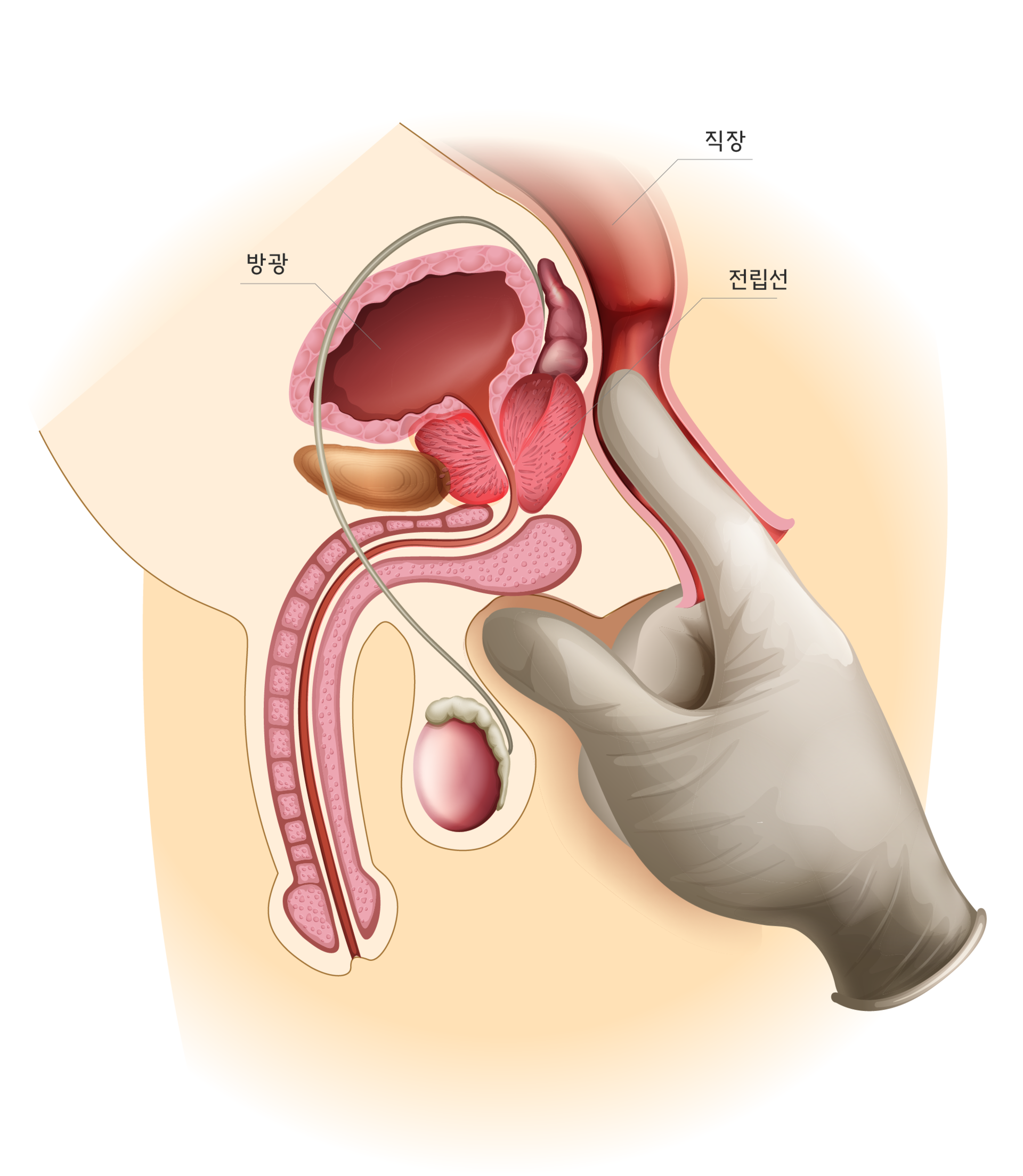 전립선마사지
