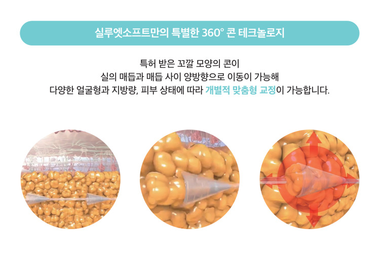 특허받은 콘이 이동 가능하여 개별 맞춤형 교정이 가능한 콘테크놀로지 실루엣소프트 리프팅 원주피부과 원더스의원