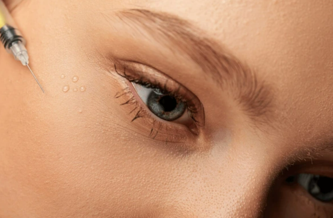 자연스럽고 사랑스러운 눈매 애교필러 시술 클로즈업 이미지 원주피부과 원더스의원