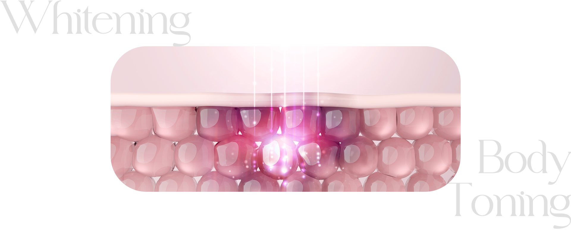 바디토닝으로 멜라닌 색소를 없애는 모습. 보라색의 레이저가 멜라닌 색소를 선택적으로 파괴하는 모습이다.