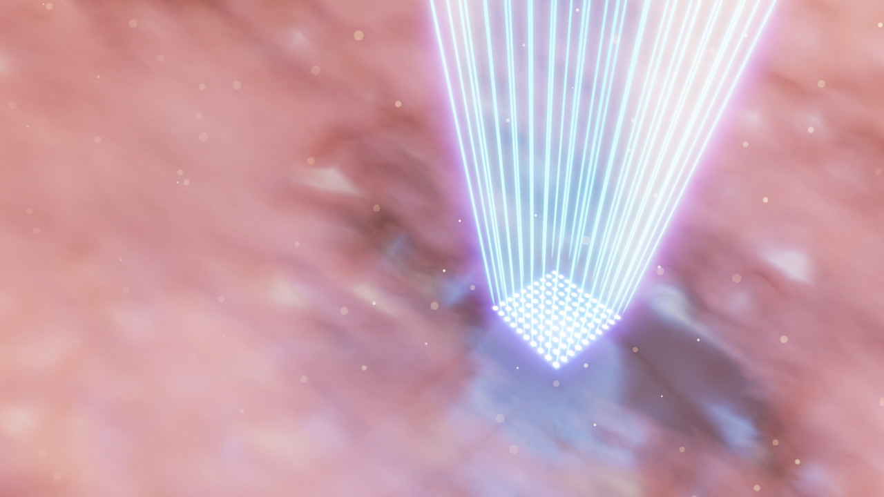 색소치료로 멜라닌 색소를 파괴하고 있는 모습의 이미지입니다. 푸른색의 레이저가 사각형 모양을 피부에 쏘아지고 있습니다.