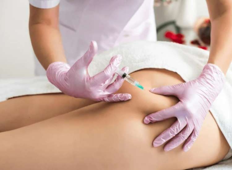 원하는 부위의 사이즈감소 지방파괴 지방세포파괴 원주피부과 원더스의원