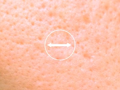 사람의 피부를 확대한 사진입니다. 사진 중앙에 화살표가 좌우로 뻗어있습니다.